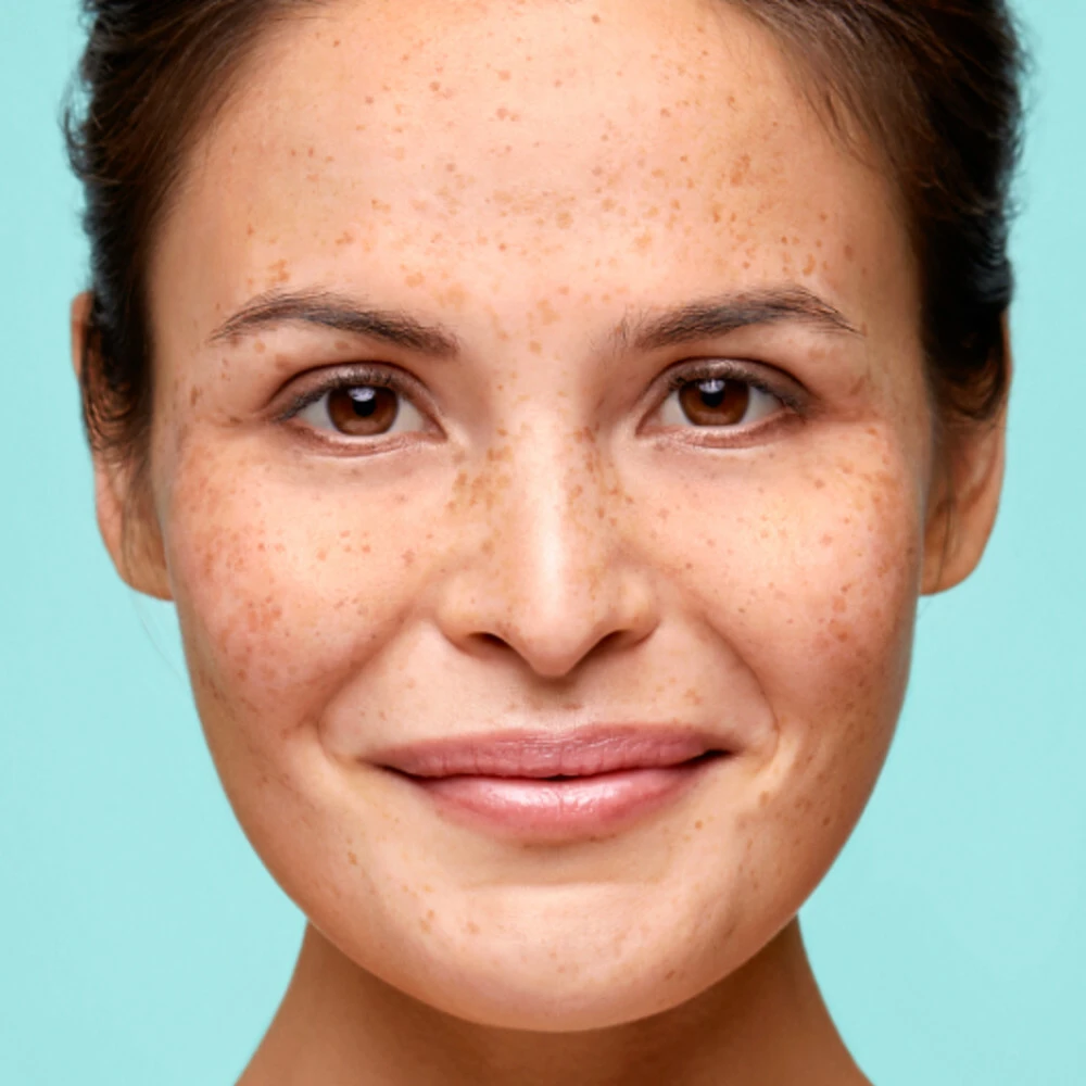 Biodermal Littekencreme - Afbeelding 2